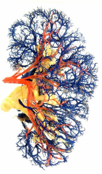 Pathology, anatomy, casts and models